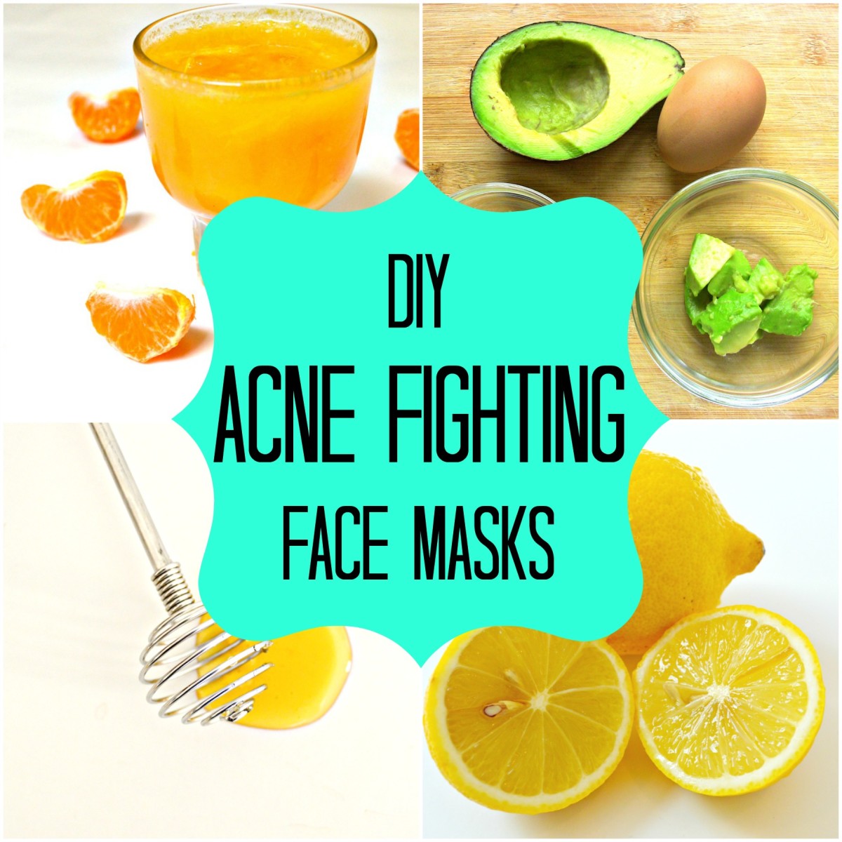 Diy Acne Face Mask Fresh Diy Homemade Face Masks for Acne How to Stop Pimples Naturally